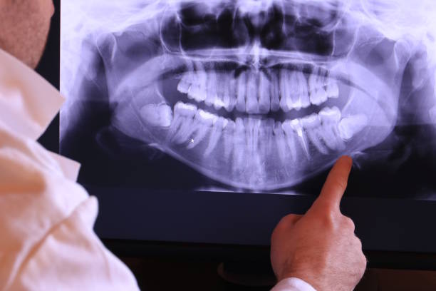 Best Knocked-Out Tooth Emergency  in Grand Bay, AL